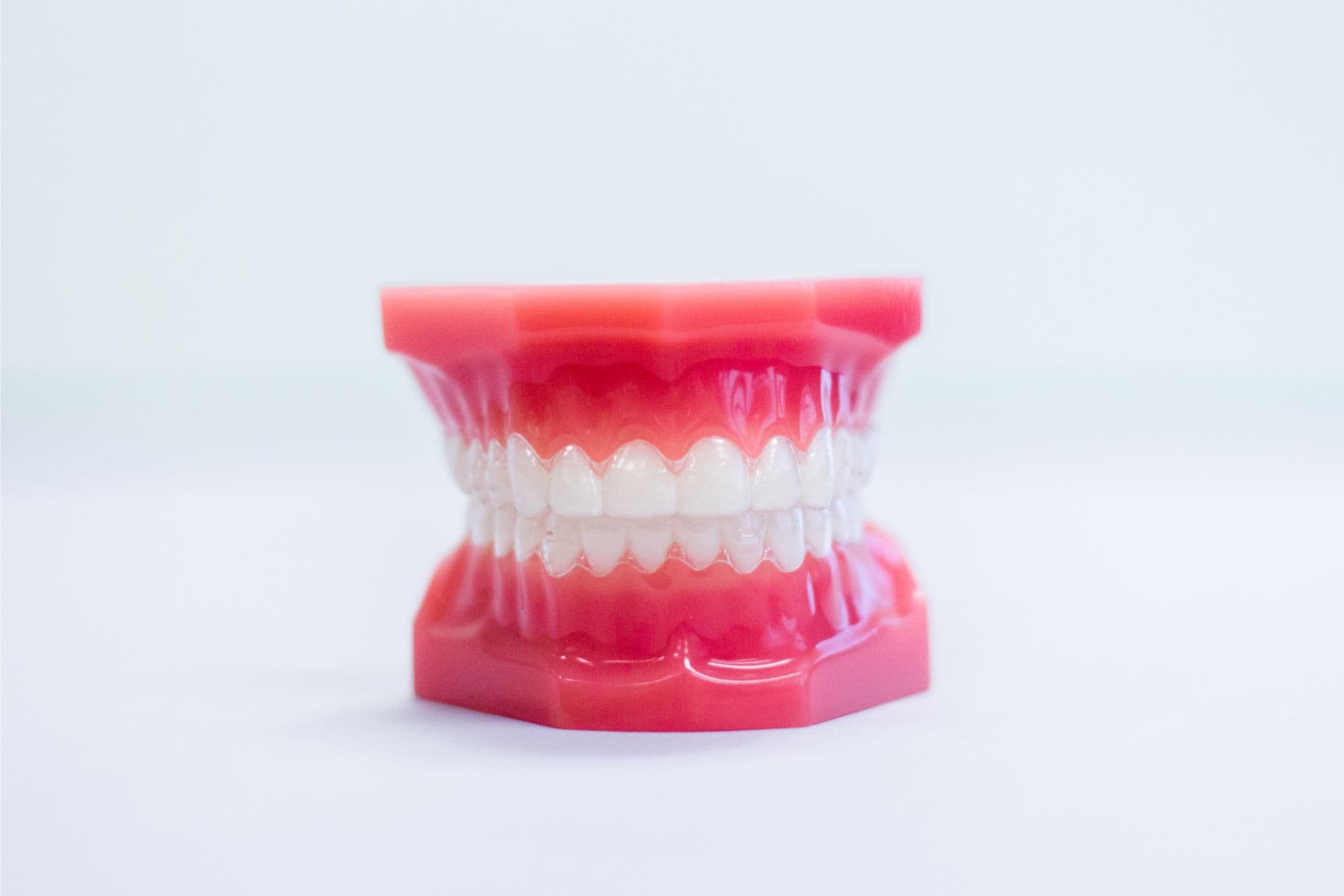 Invisalign Mold
